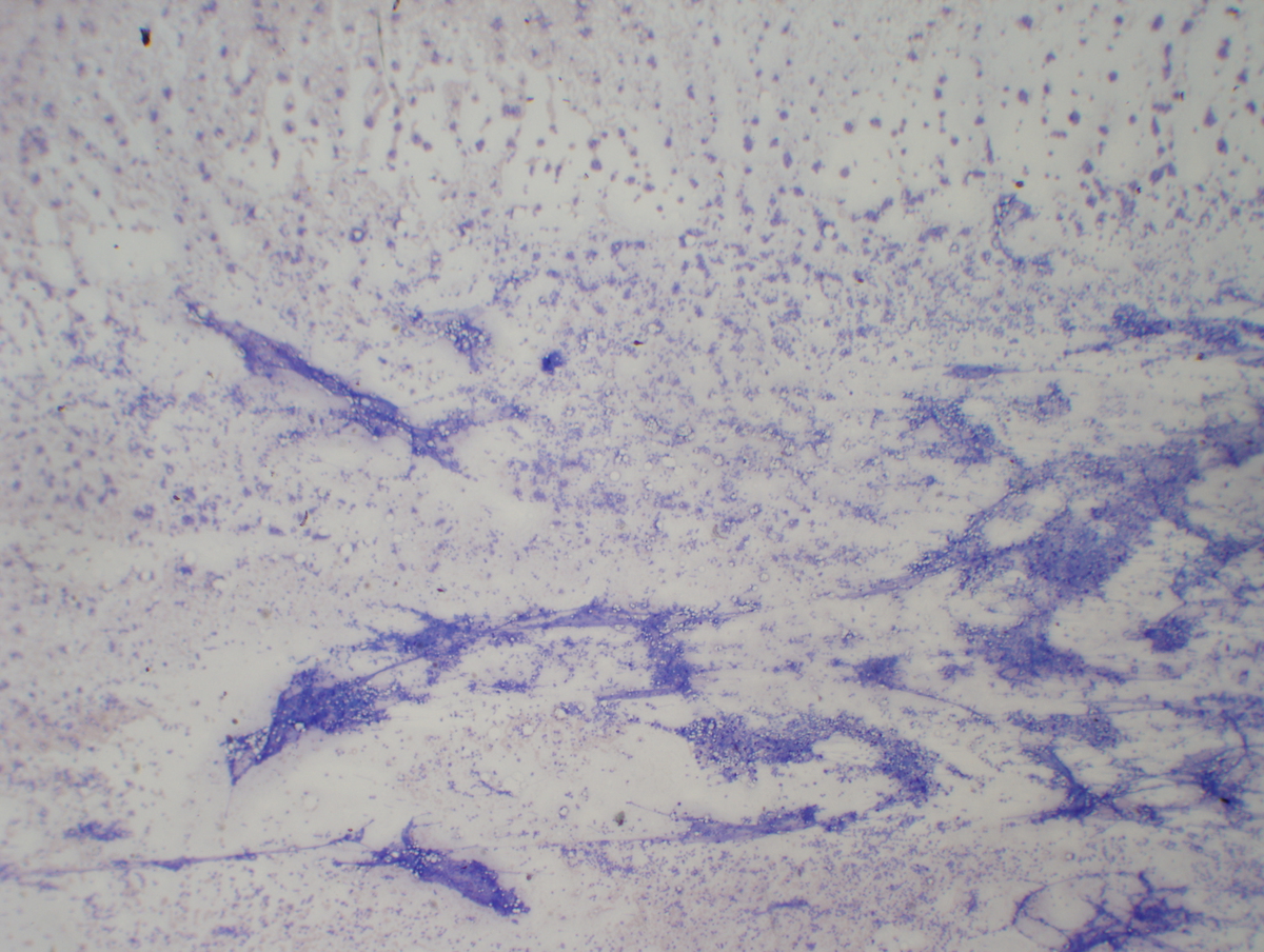 Aspirate smear (10x)